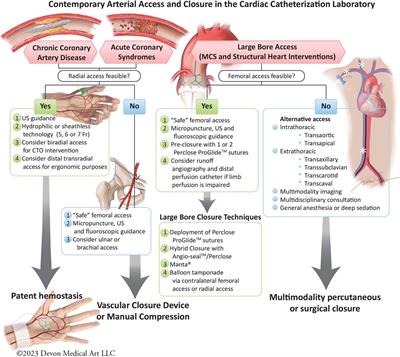 Best practices for vascular arterial access and closure: a contemporary guide for the cardiac catheterization laboratory